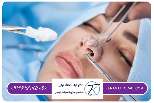 عمل بینی بدون تامپون