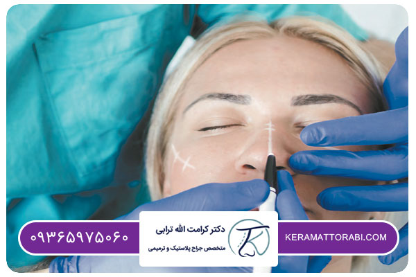 عمل بيني بدون تامپون در تهران چگونه است؟