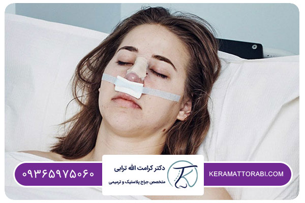 مدت استراحت بعد از عمل بینی بدون تامپون&nbsp;| دکتر کرامت الله ترابی