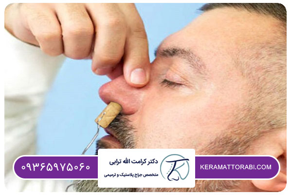مزايا و معايب عمل بيني با تامپون چيست؟ | دكتر كرامت الله ترابي