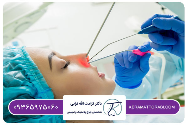 نحوه عمل بینی بدون تامپون با لیزر | دکتر کرامت الله ترابی