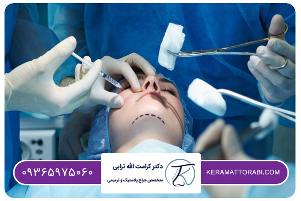 شرایط عمل بینی بدون تامپون برای ورزشکاران | دکتر کرامت الله ترابی