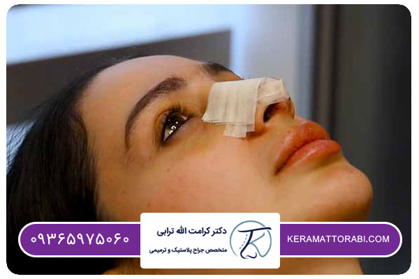 نظرات در مورد مزایای عمل بینی بدون تامپون